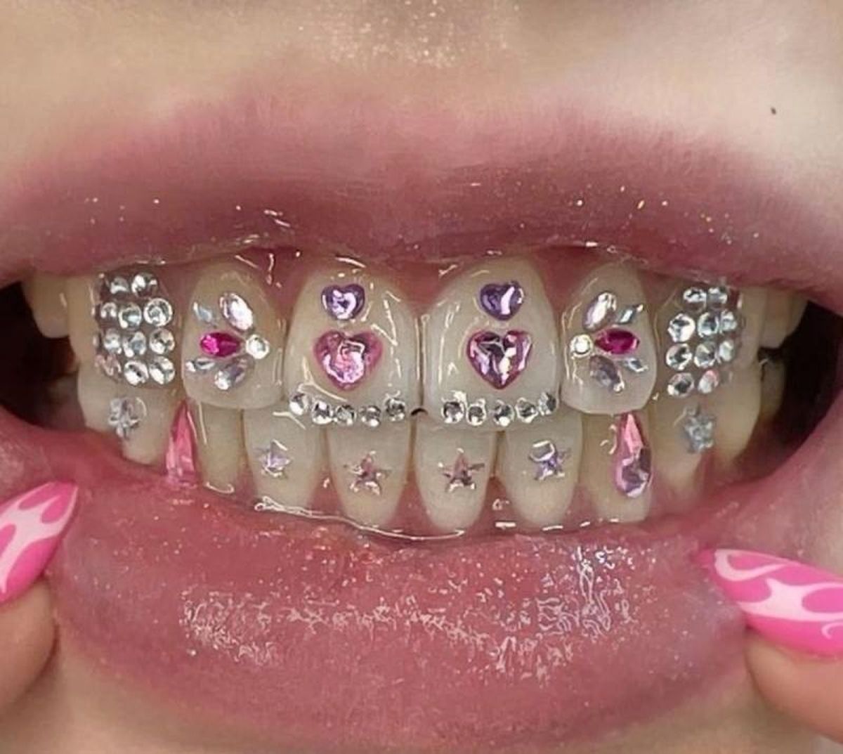 Piercings dentales de diferentes formas y colores