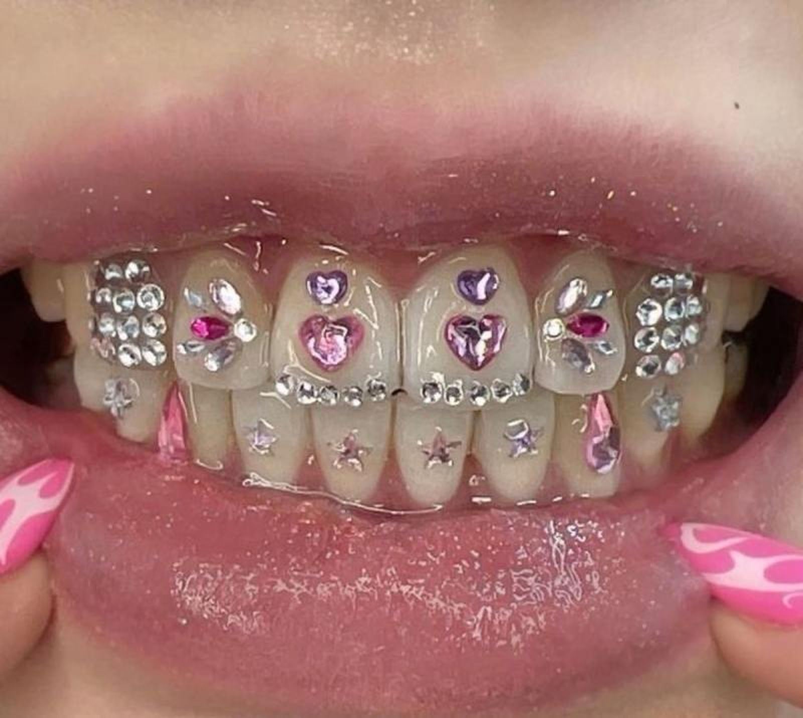 Piercings dentales de diferentes formas y colores