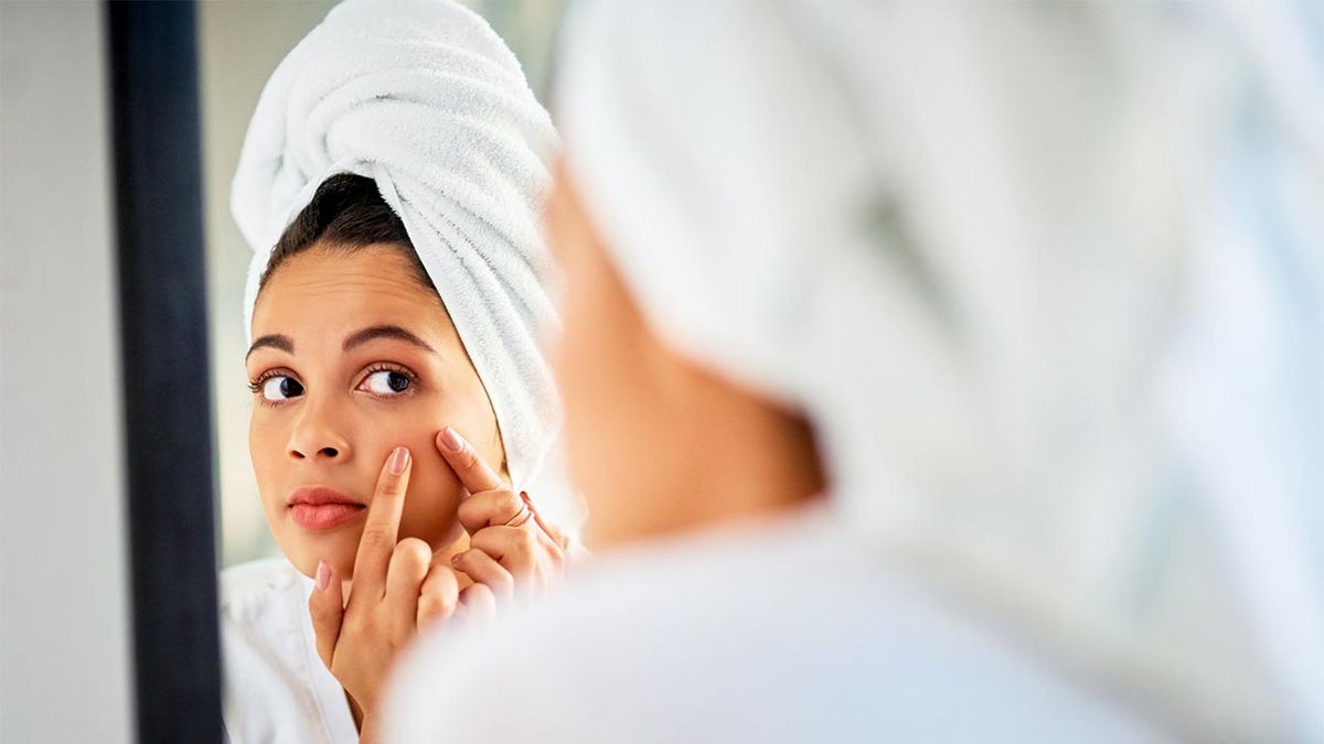 acne en el rostro por que aparece en cada zona y como evitarlo portada