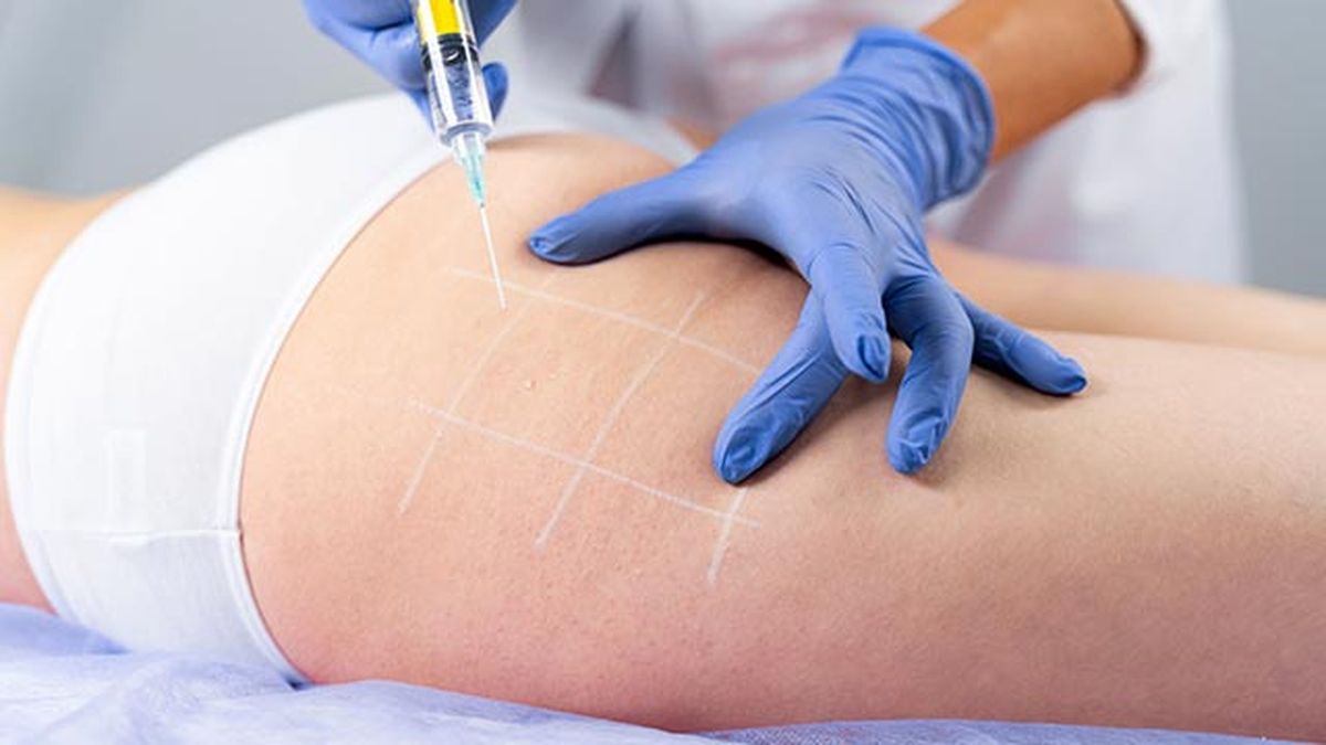 las 4 mejores cremas reafirmantes para decirle adios a la flacidez mesoterapia