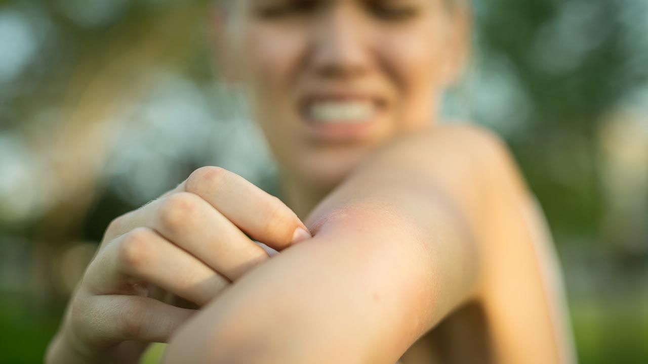 evitar mosquitos 5