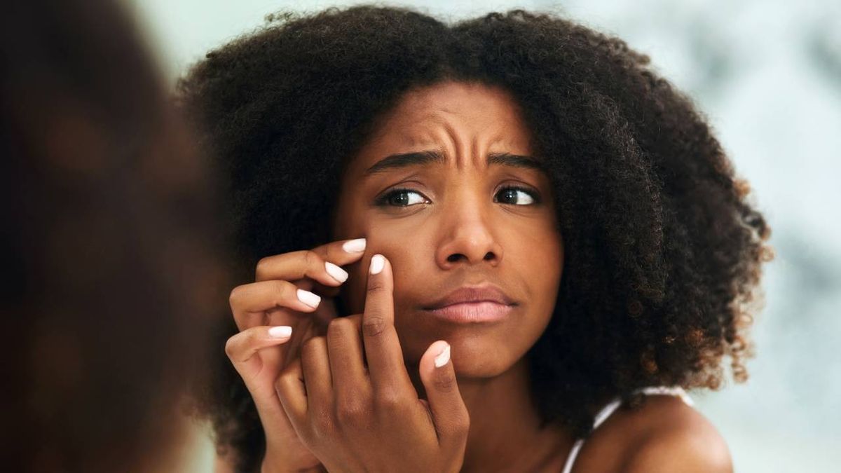 como disimular los granos portada