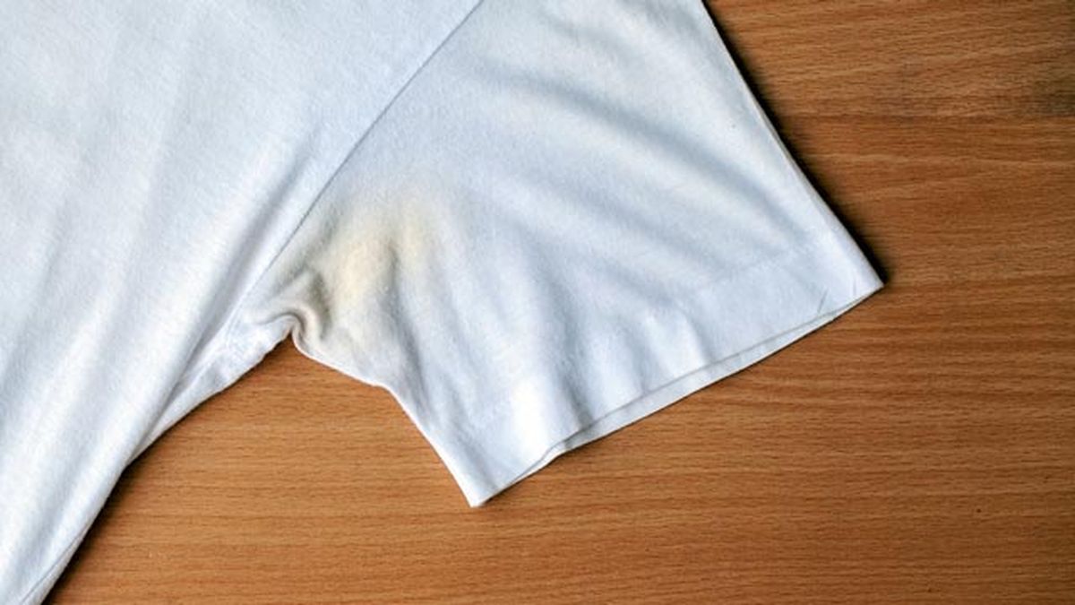 como eliminar manchas amarillas1