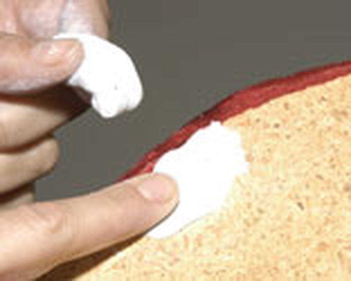 284 renov butac descal p02