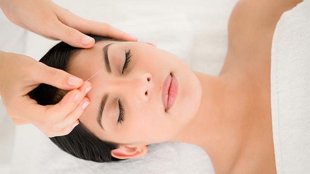 acupuntura facial que es y beneficios 3