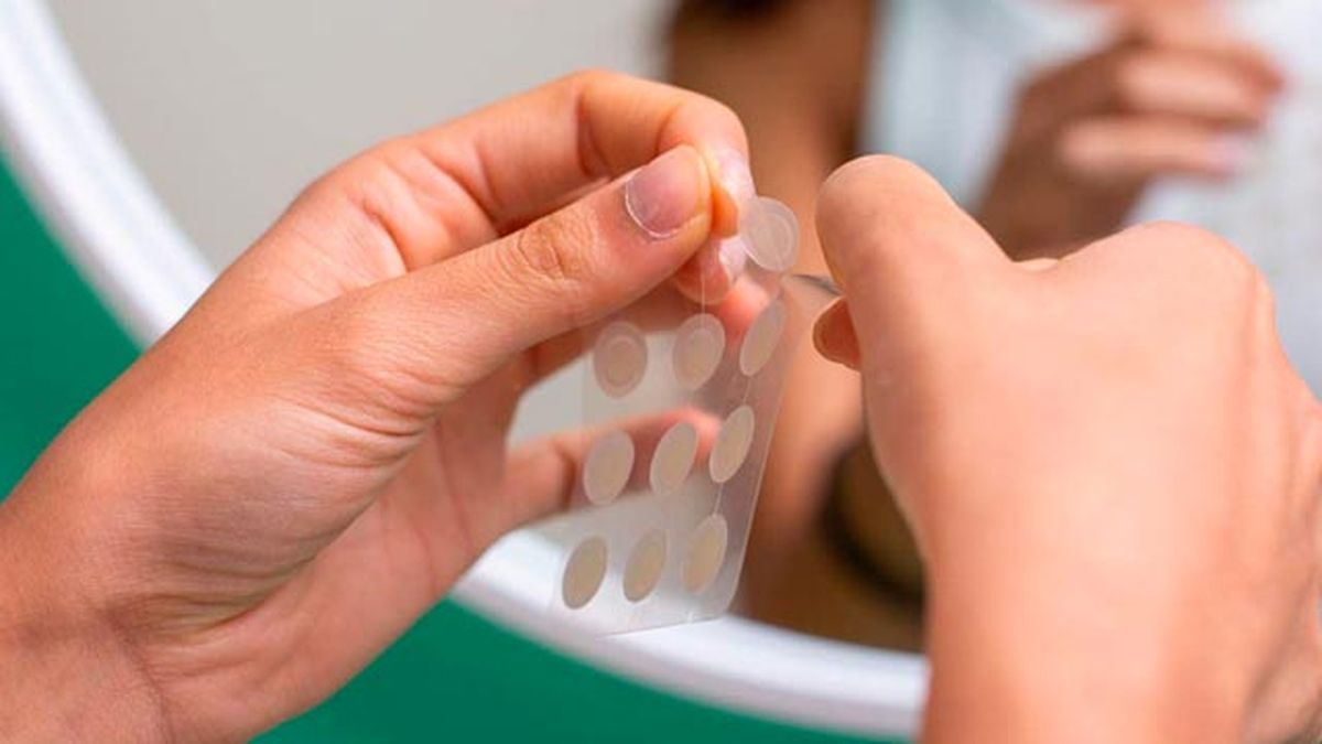 parches para granos como funcionan cuales son los mejores 1