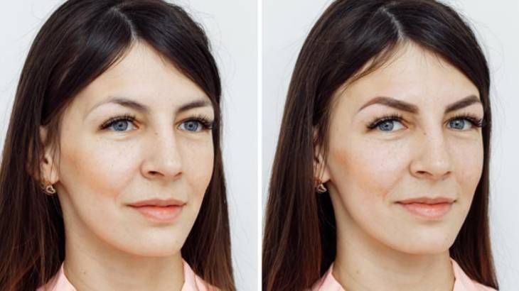 microblading antes despues resultado