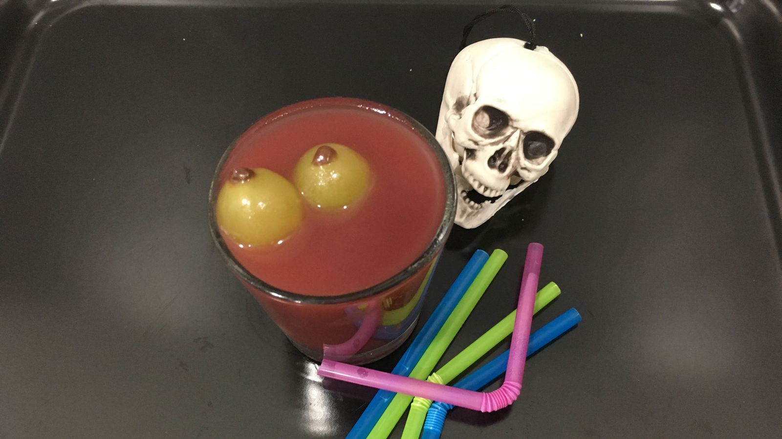 Vasos de sangre