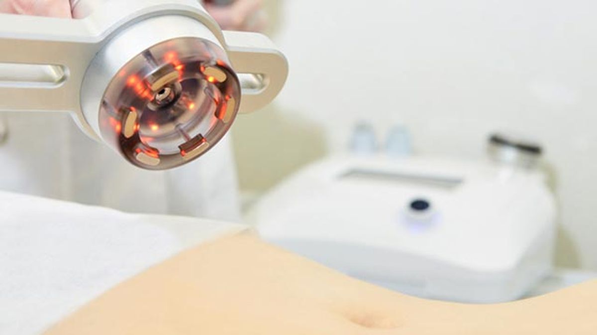 que es y para que sirve la radiofrecuencia abdomen