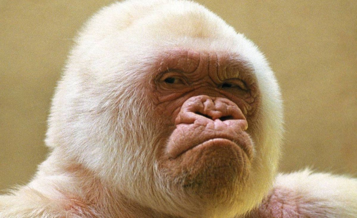 El albinismo en sí no es una enfermedad, sino que es una condición genética.