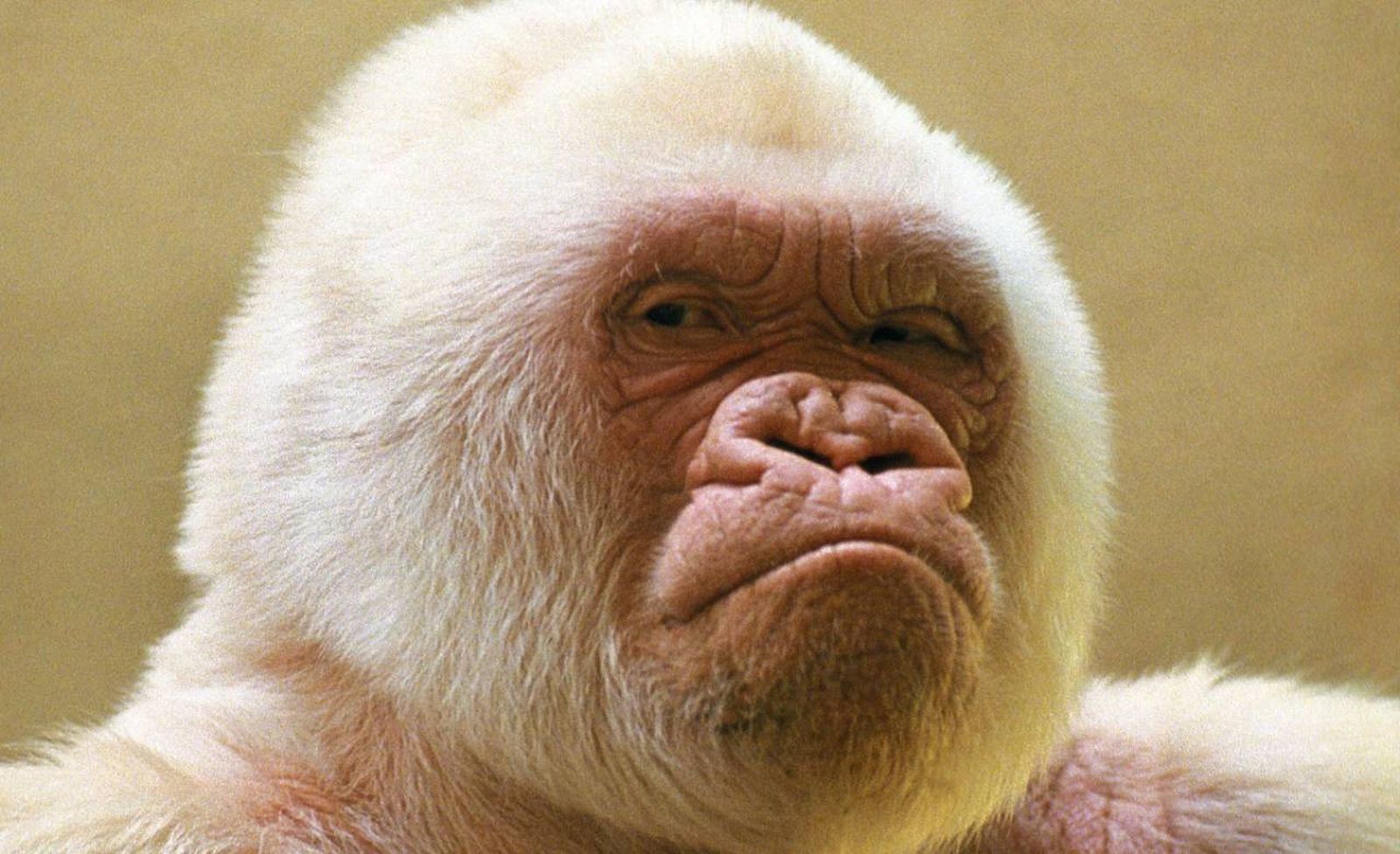 El albinismo en sí no es una enfermedad, sino que es una condición genética.