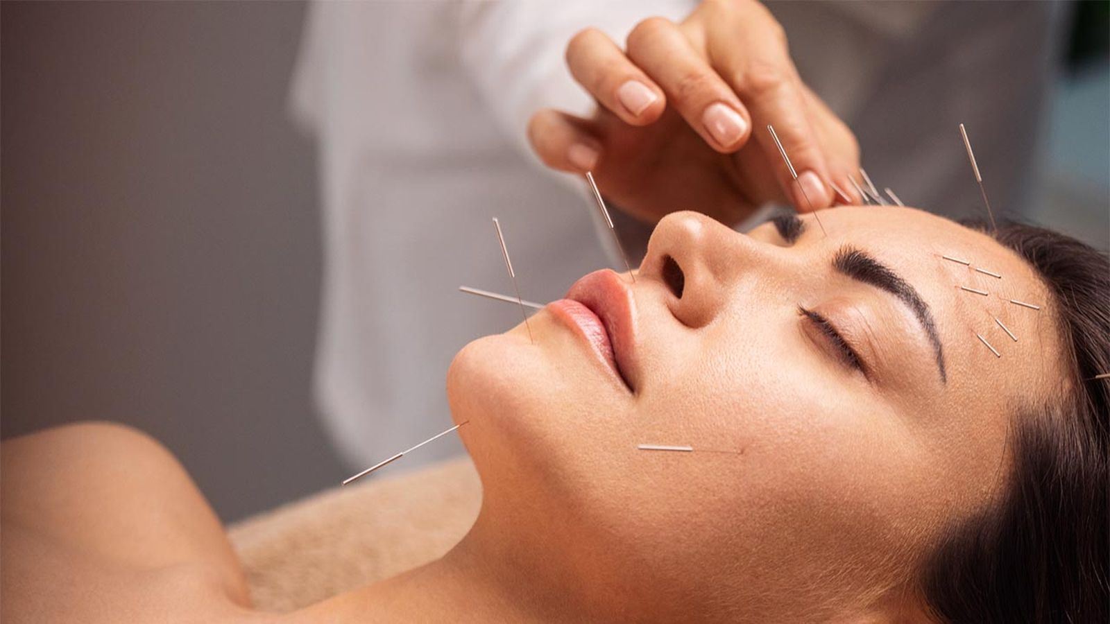 acupuntura facial que es y beneficios