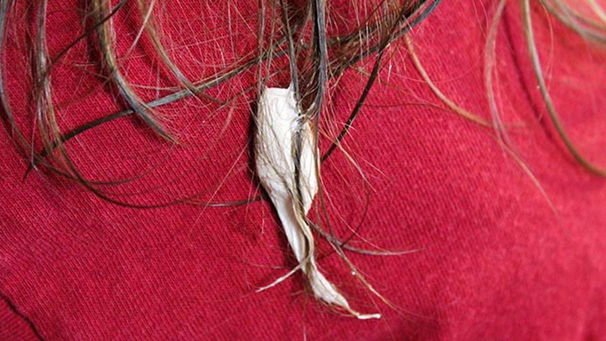 trucos para quitar un chicle del pelo 1