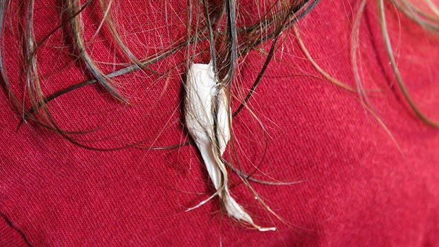 trucos para quitar un chicle del pelo 1