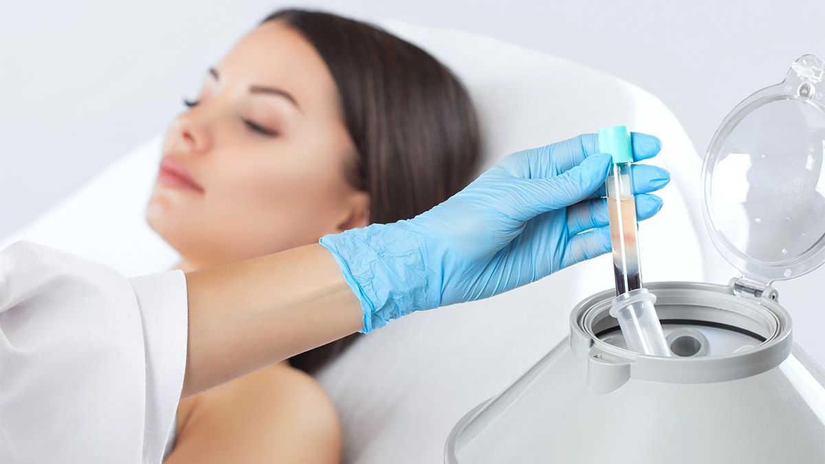 belleza PRP capilar tratamiento plasma rico plaquetas maquina centrifugadora sangre
