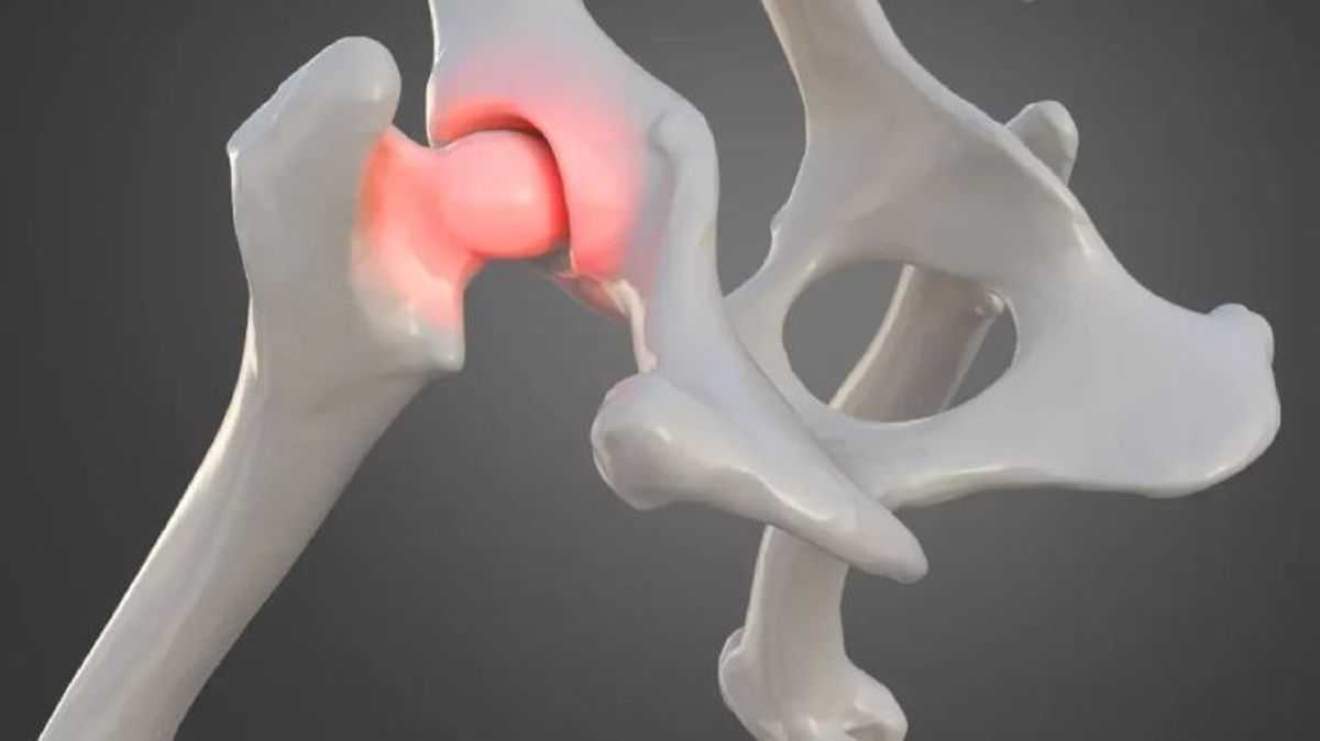 displasia de cadera en perros 3