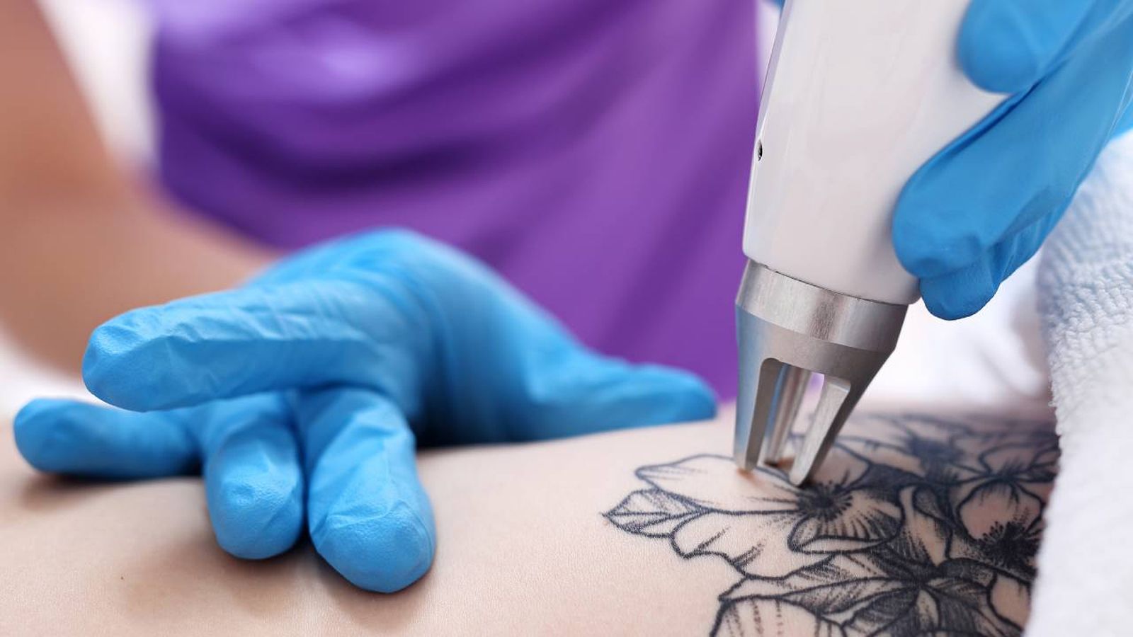 eliminar tatuaje laser tipos tatuajes arrepentimiento portada