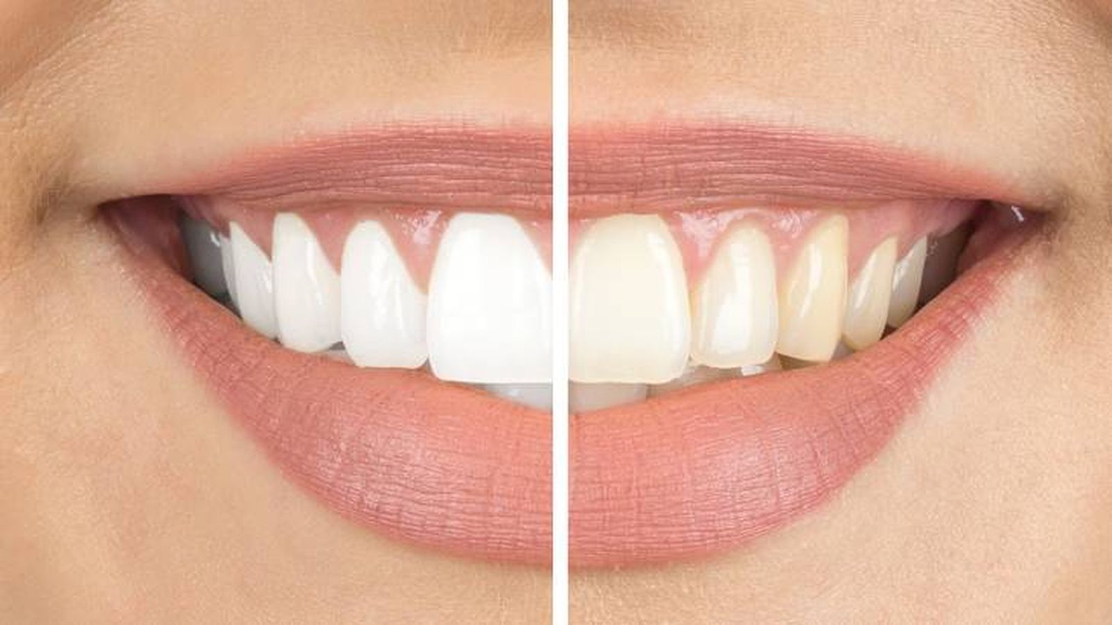 pasta dientes blanqueadora tono dientes