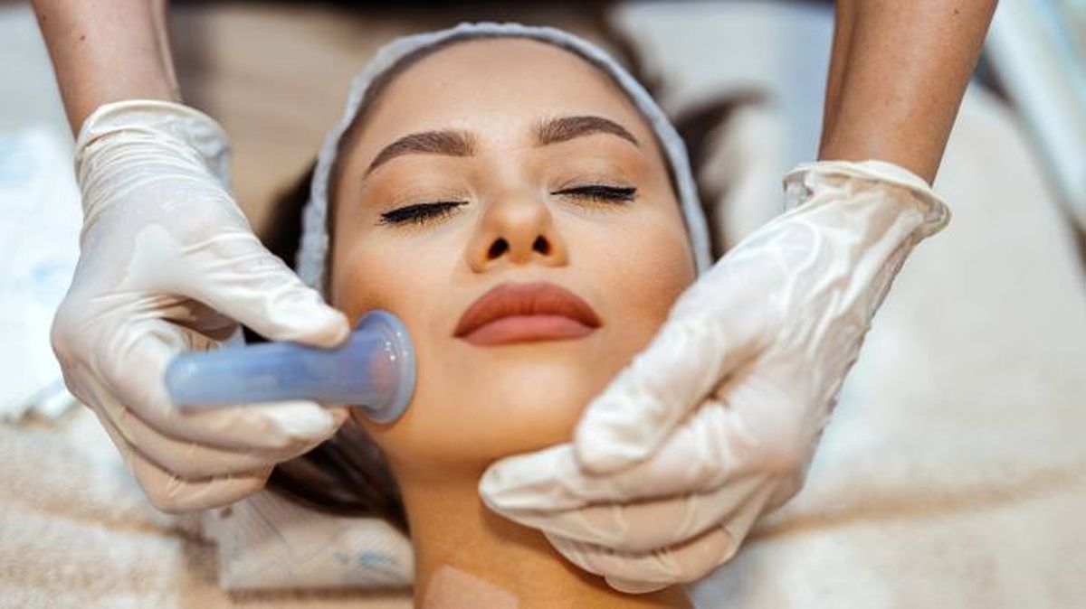tratamiento cupping facial ventosaterapia