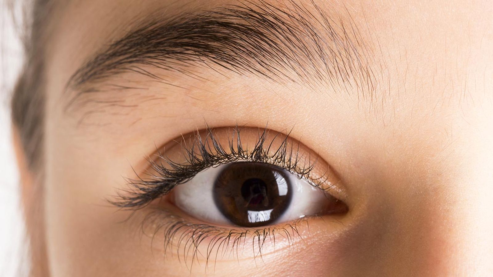 caspa en las pestanas por que aparace remedios portada