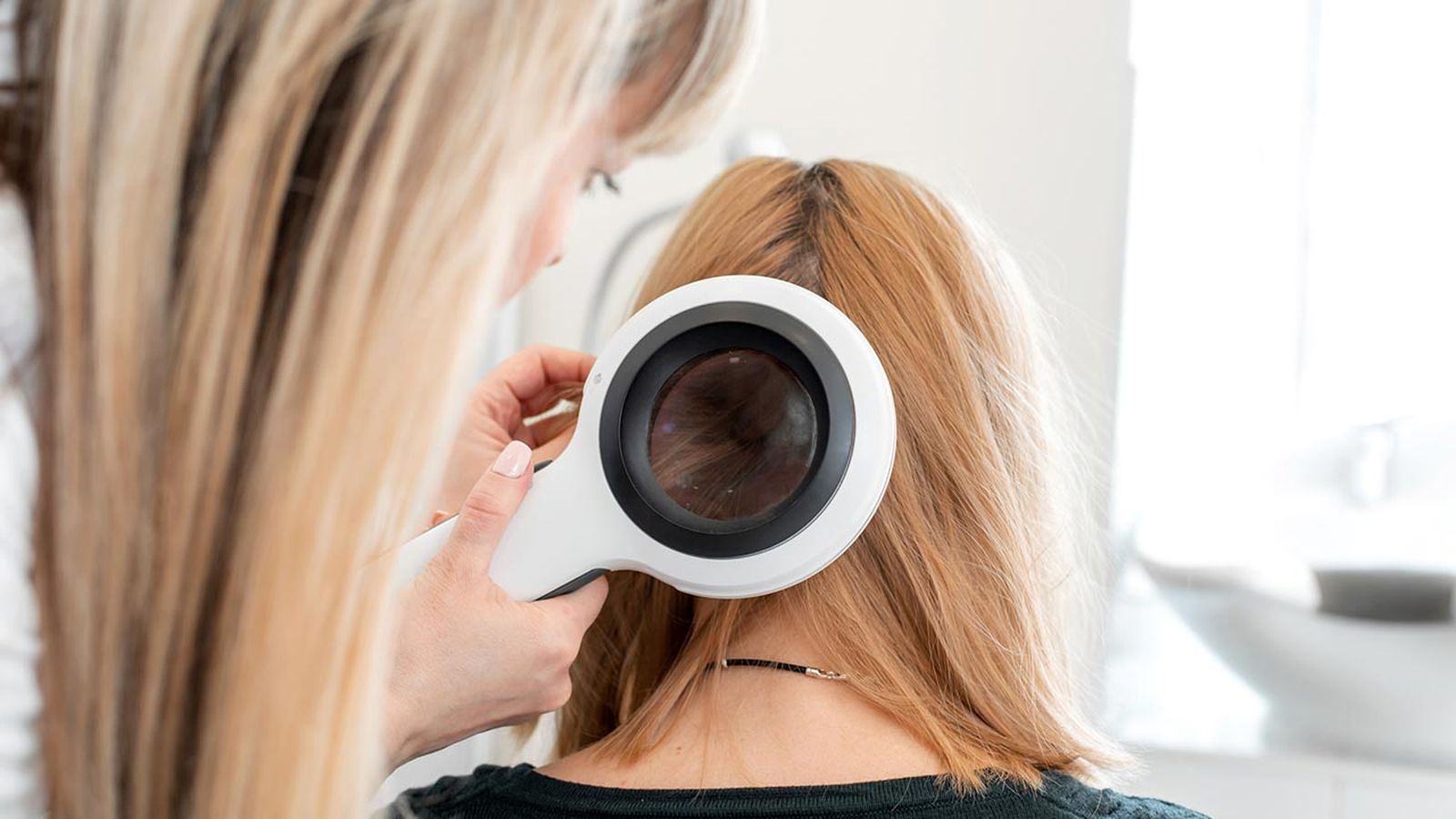 5 preguntas respuestas injerto capilar