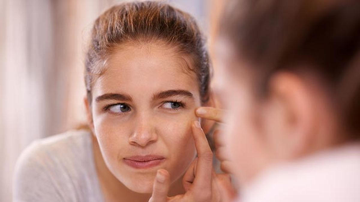 tipos de granos en la cara acne