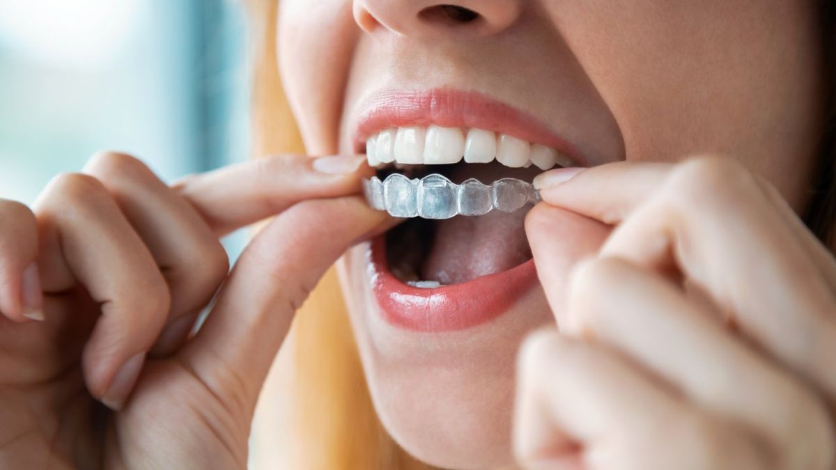 como limpiar desinfectar ferula dental