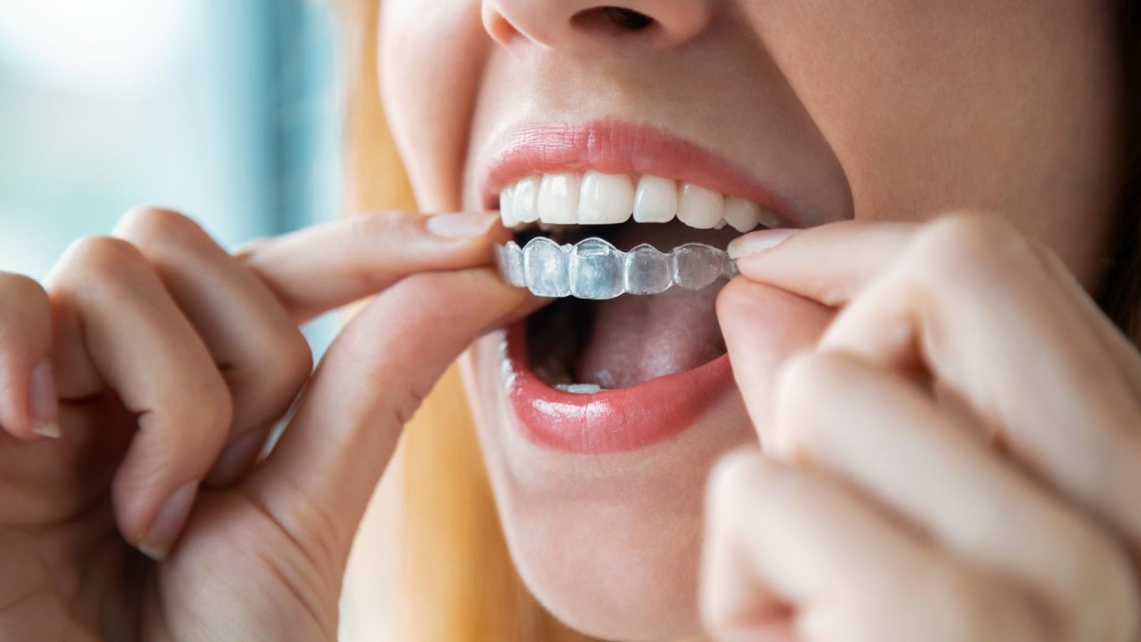 como limpiar desinfectar ferula dental