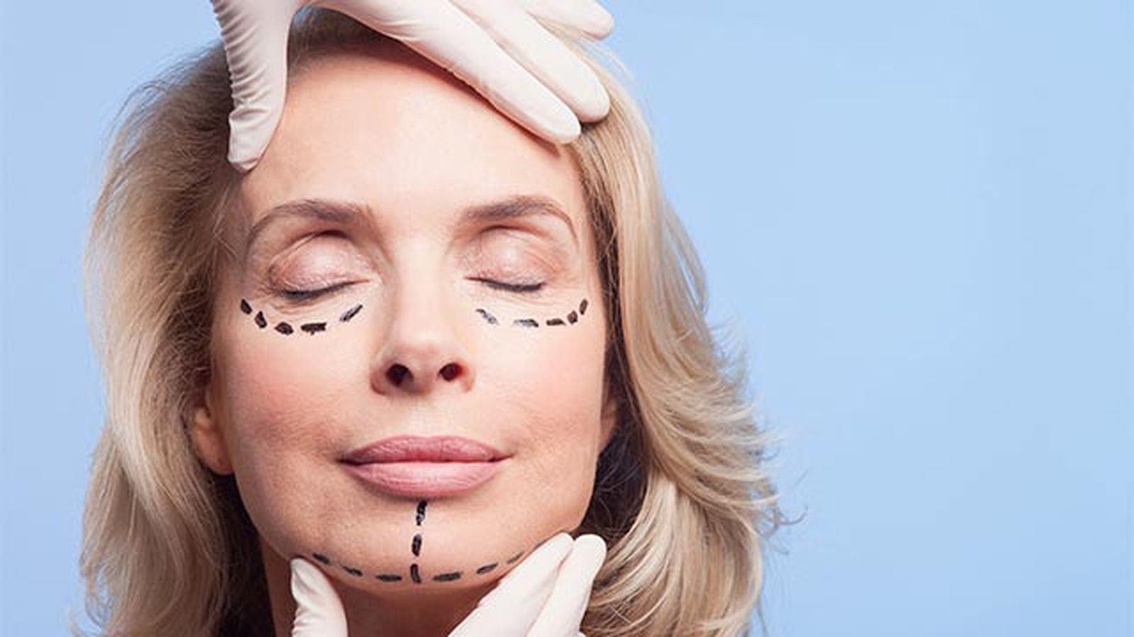 todo lo que debes saber sobre el aumento de labios sin cirugia estetica