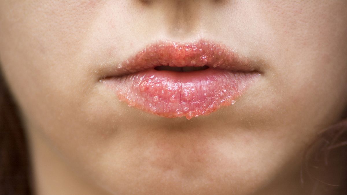 como exfoliar los labios recetas caseras con azucar y vaselina