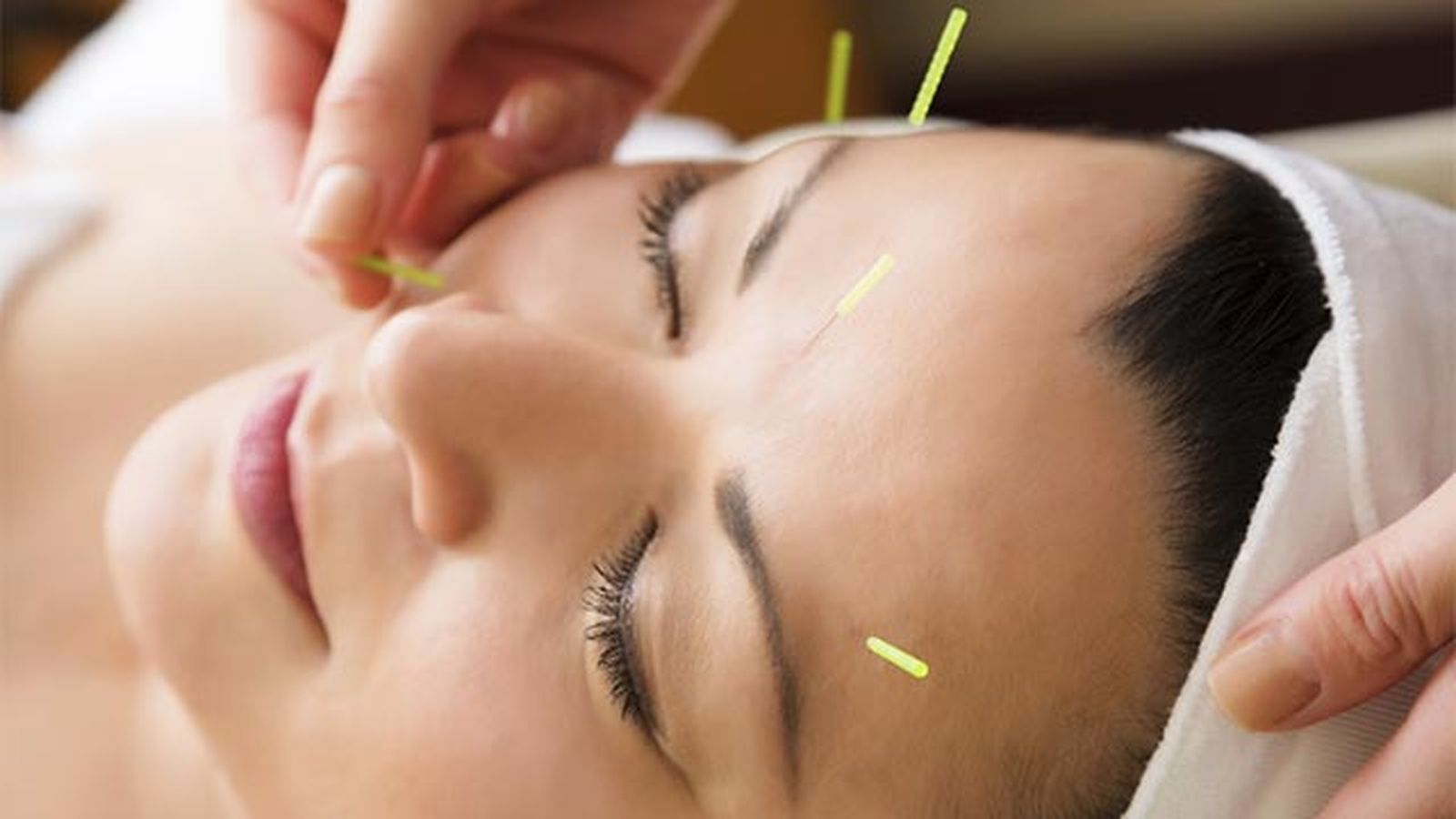 acupuntura facial que es y beneficios 2