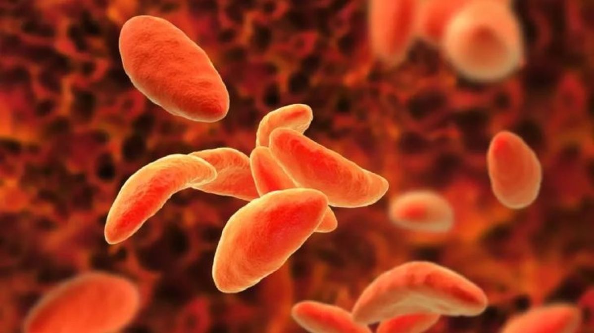 toxoplasmosis en gatos 1