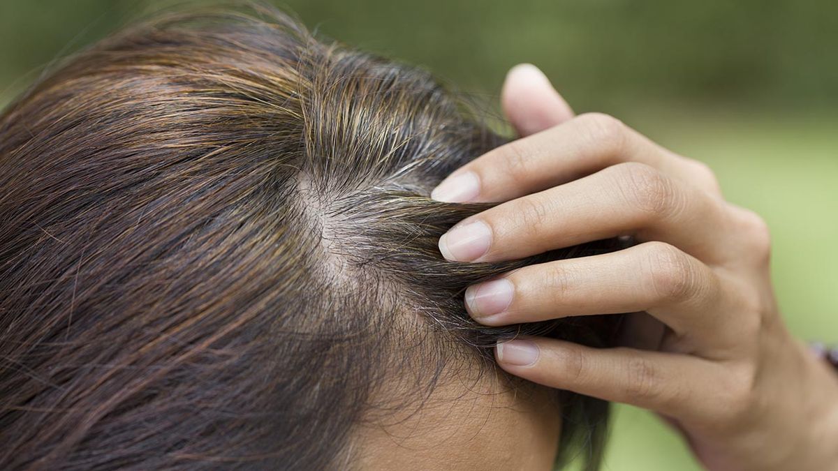 arrancar cana hace que salgan mas