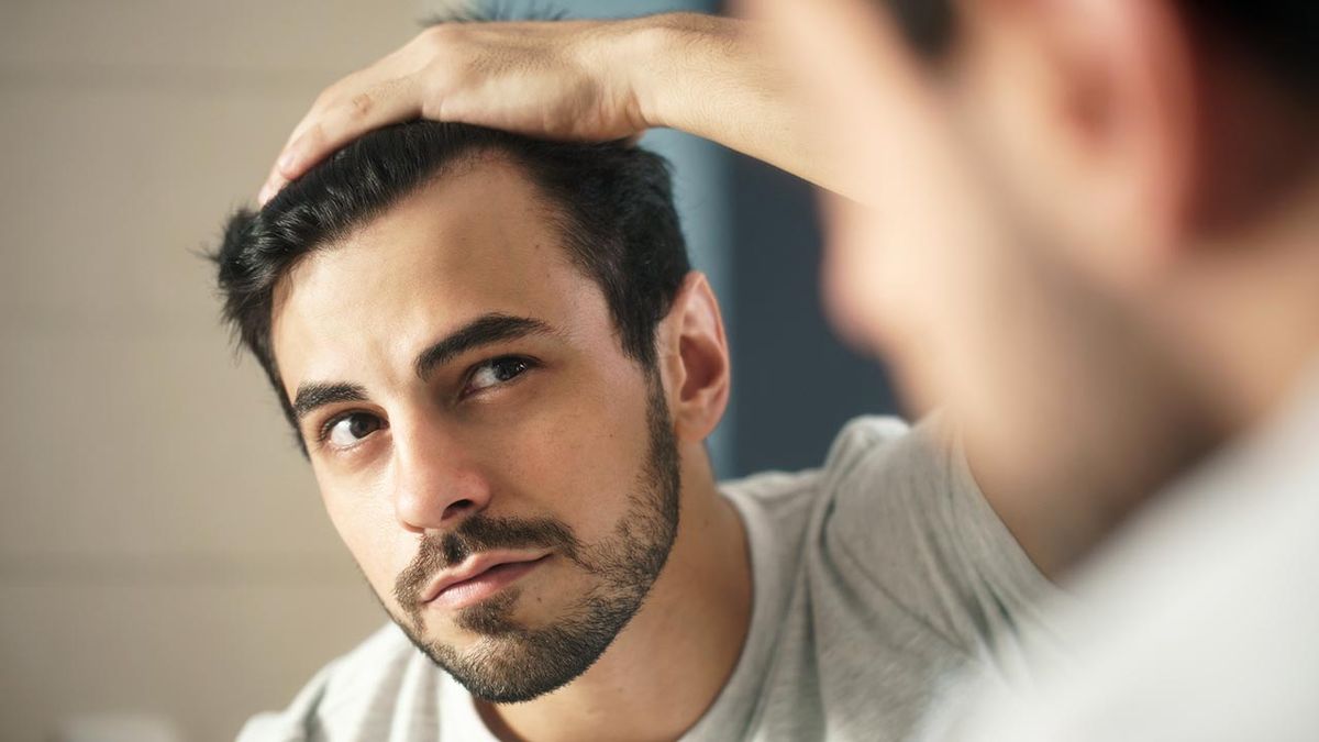5 preguntas respuestas injerto capilar alopecia
