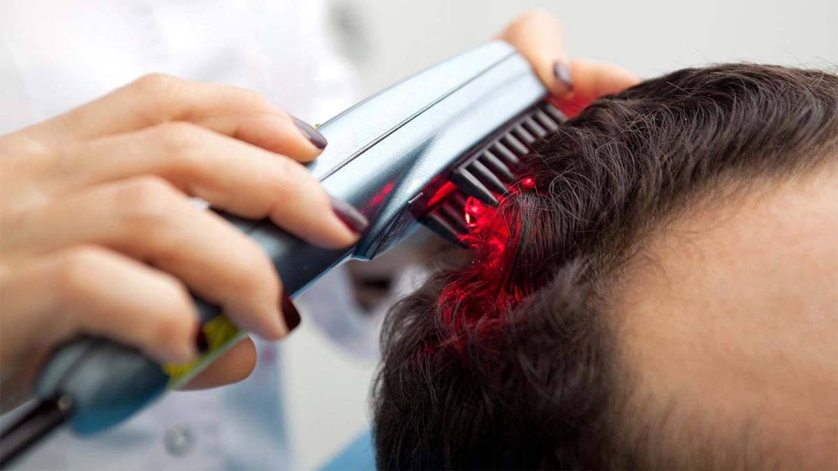 belleza tratamiento capilar laser pelo