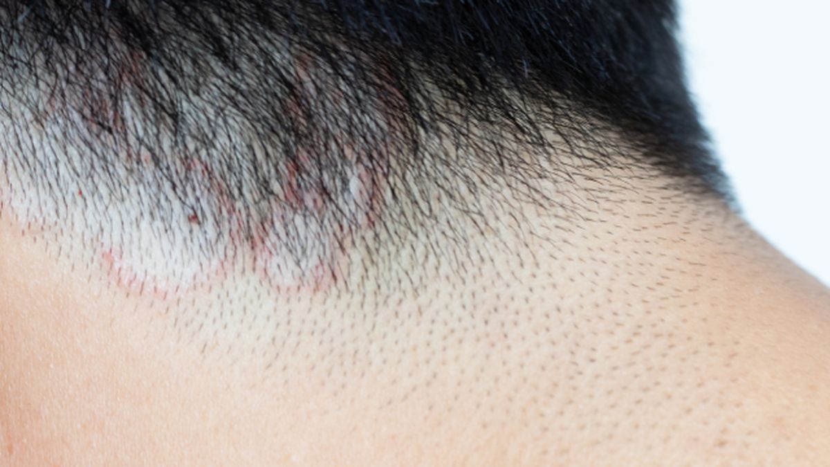 todo sobre la tina que ha provocado un brote en peluquerias ejemplo