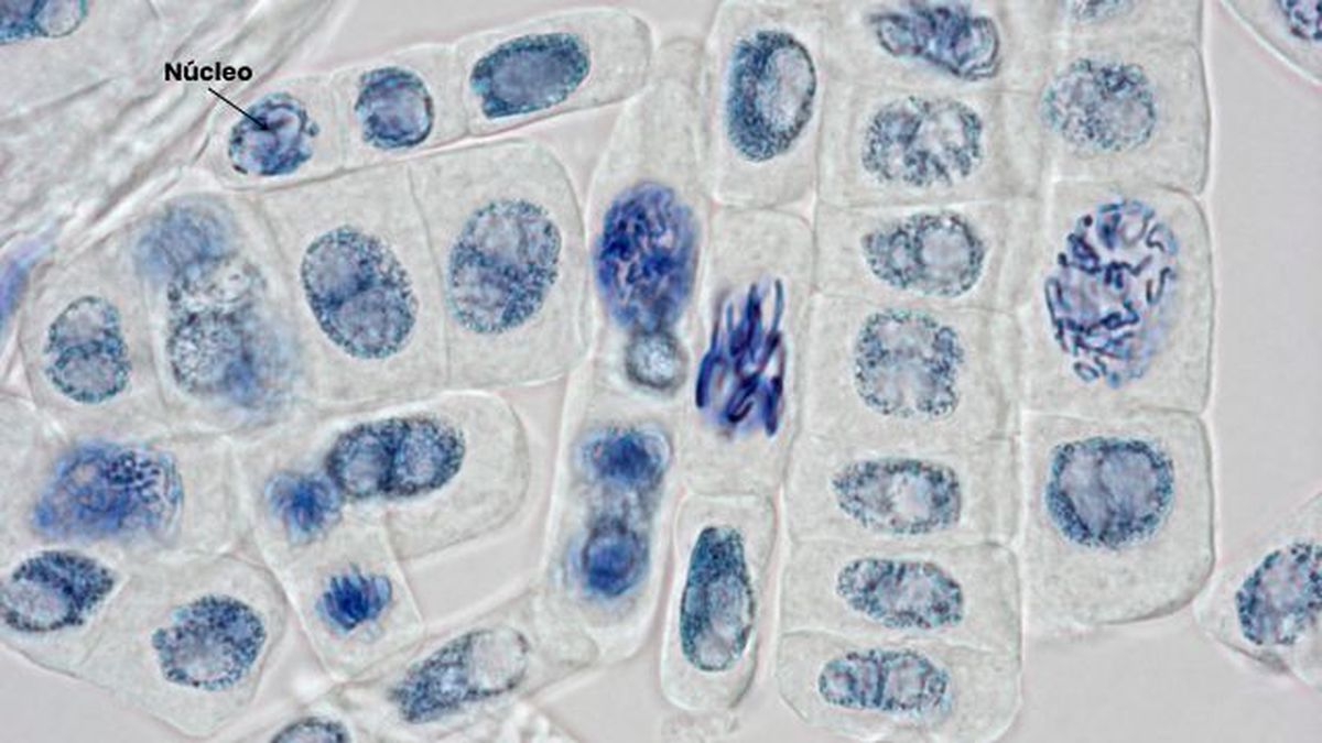 nucleo celula vegetal