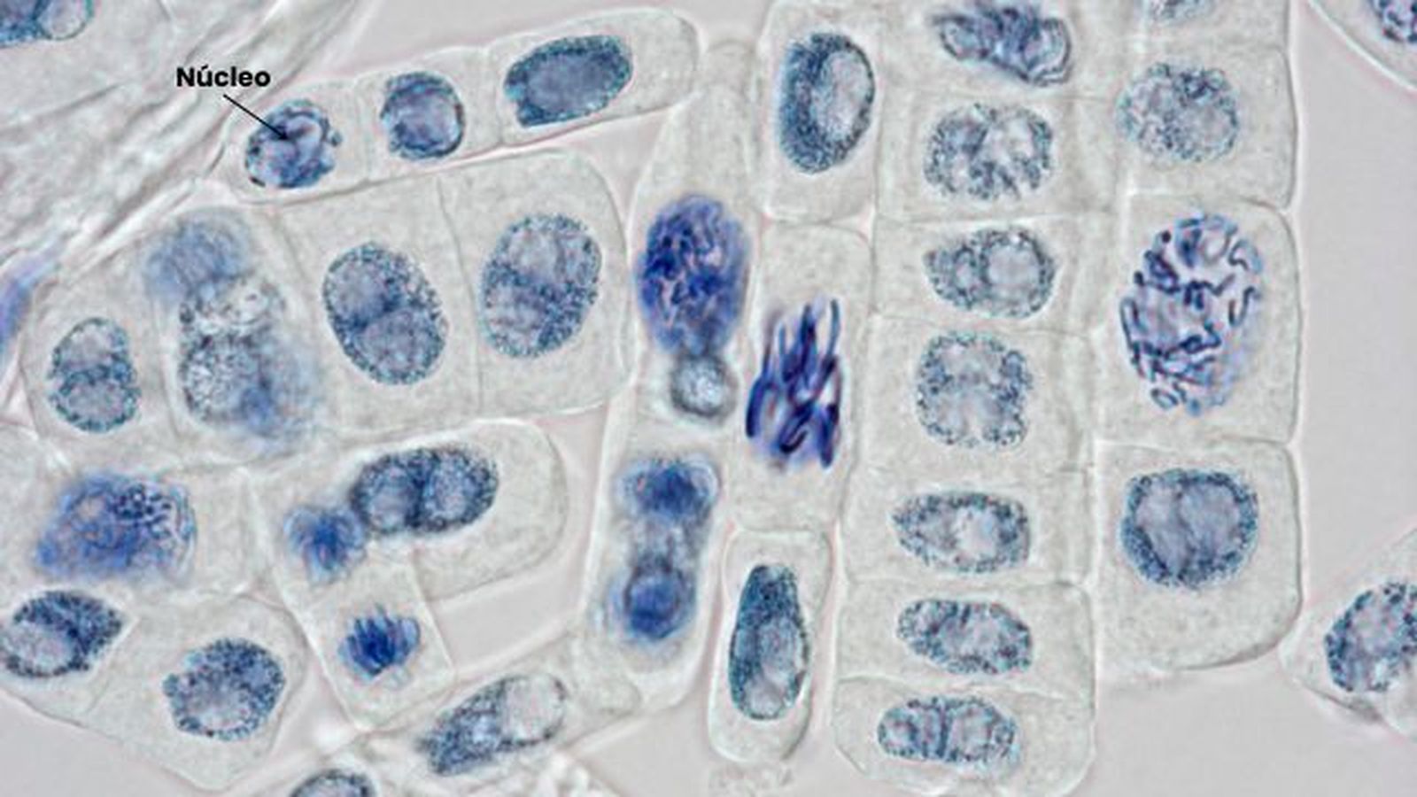 nucleo celula vegetal