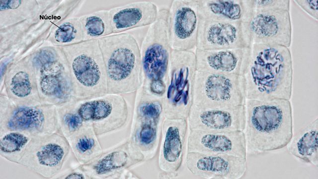 nucleo celula vegetal