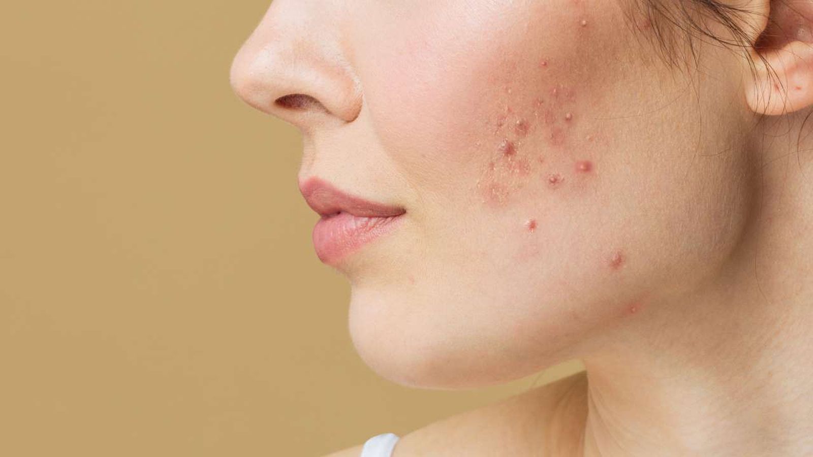 efectos de la contaminacion en la piel (1)