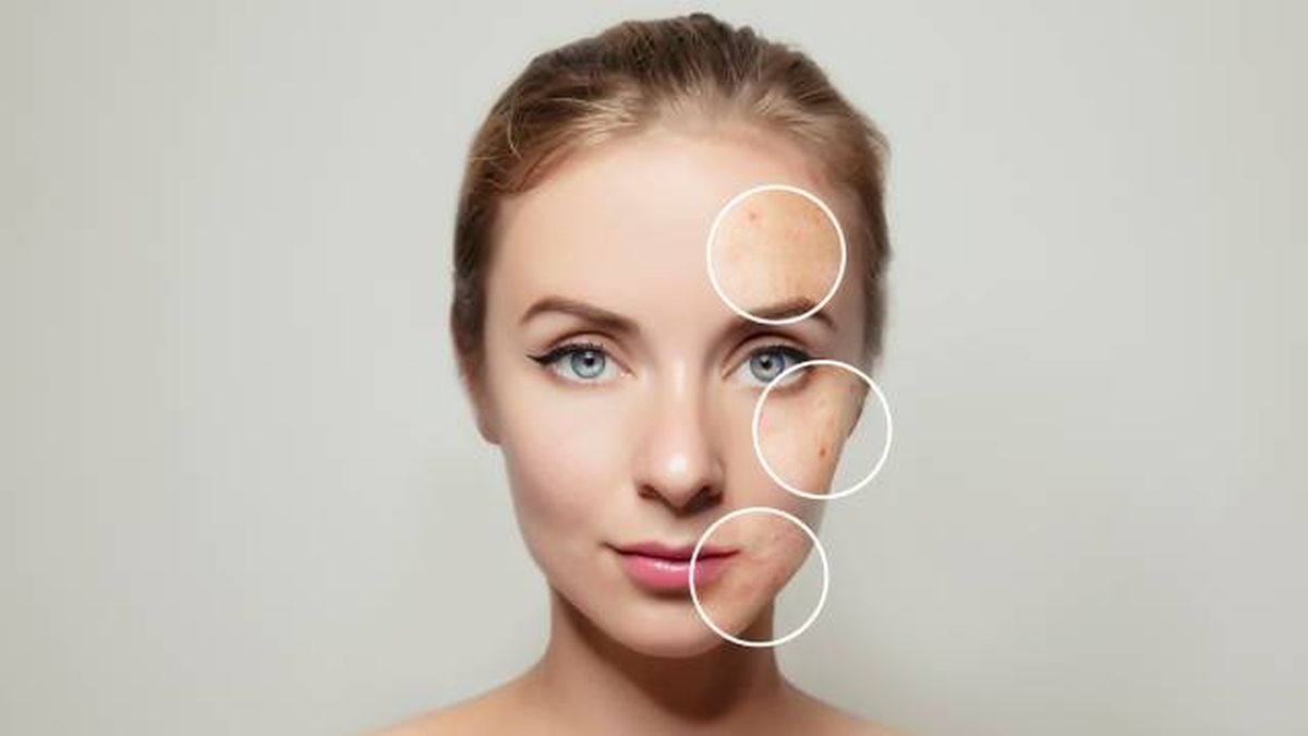 sintomas caracteristicas piel asfictica