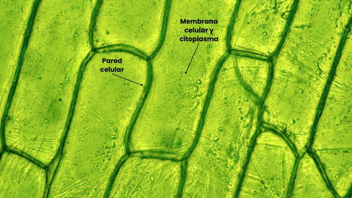 membrana celular citroplasma y pared celular