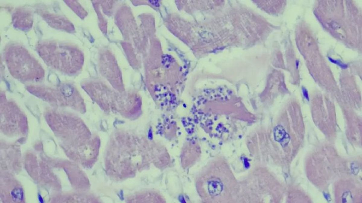 toxoplasmosis en gatos 4