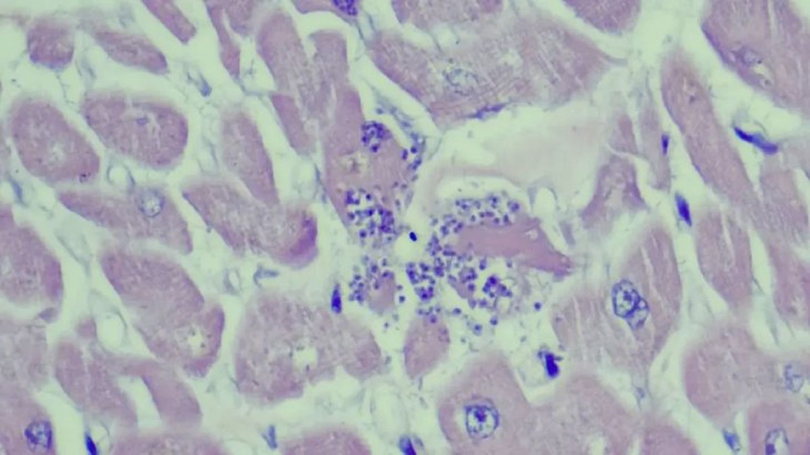 toxoplasmosis en gatos 4