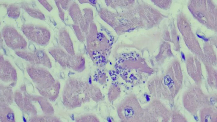 toxoplasmosis en gatos 4